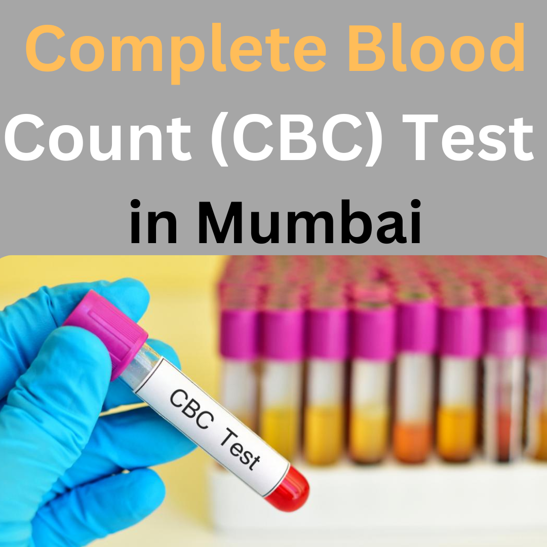 Complete Blood Count (CBC) Test Price in Mumbai, Book Online red