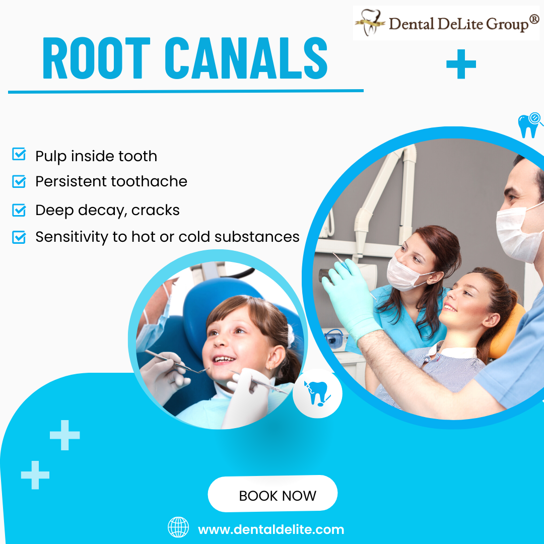 Understanding Root Canals Dallas, TX The Basics of Exploring the