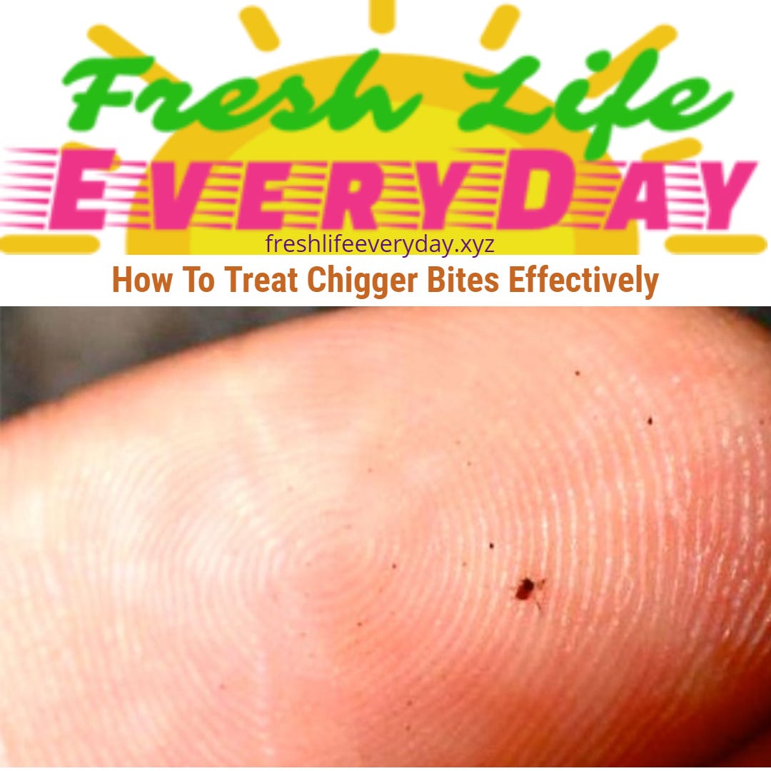 How to treat chigger bites effectively by freshlifeeveryday xyz medium