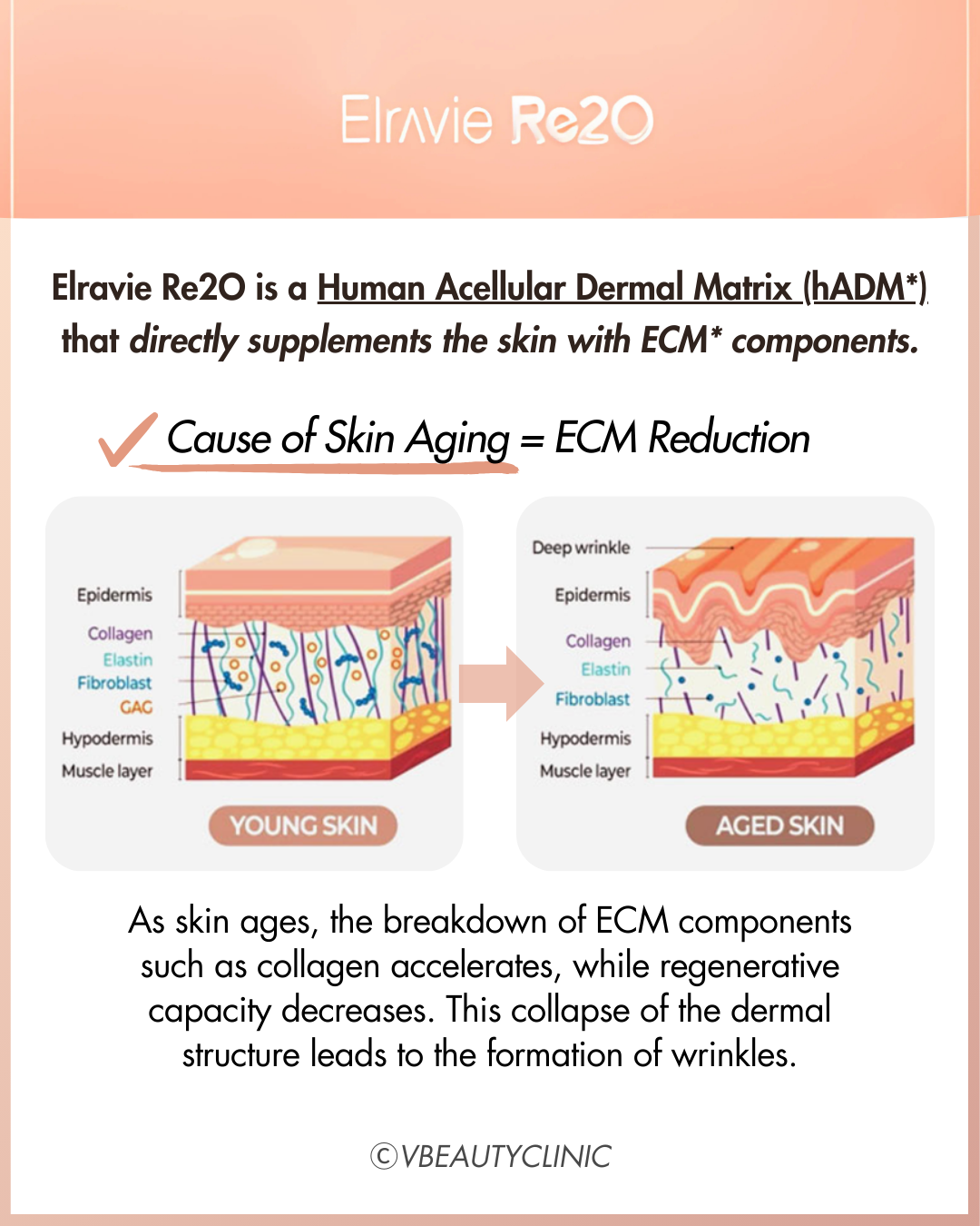Elravie Re2O: Korea’s Next-Gen Skin Booster That Even Kim Kardashian Flew In For