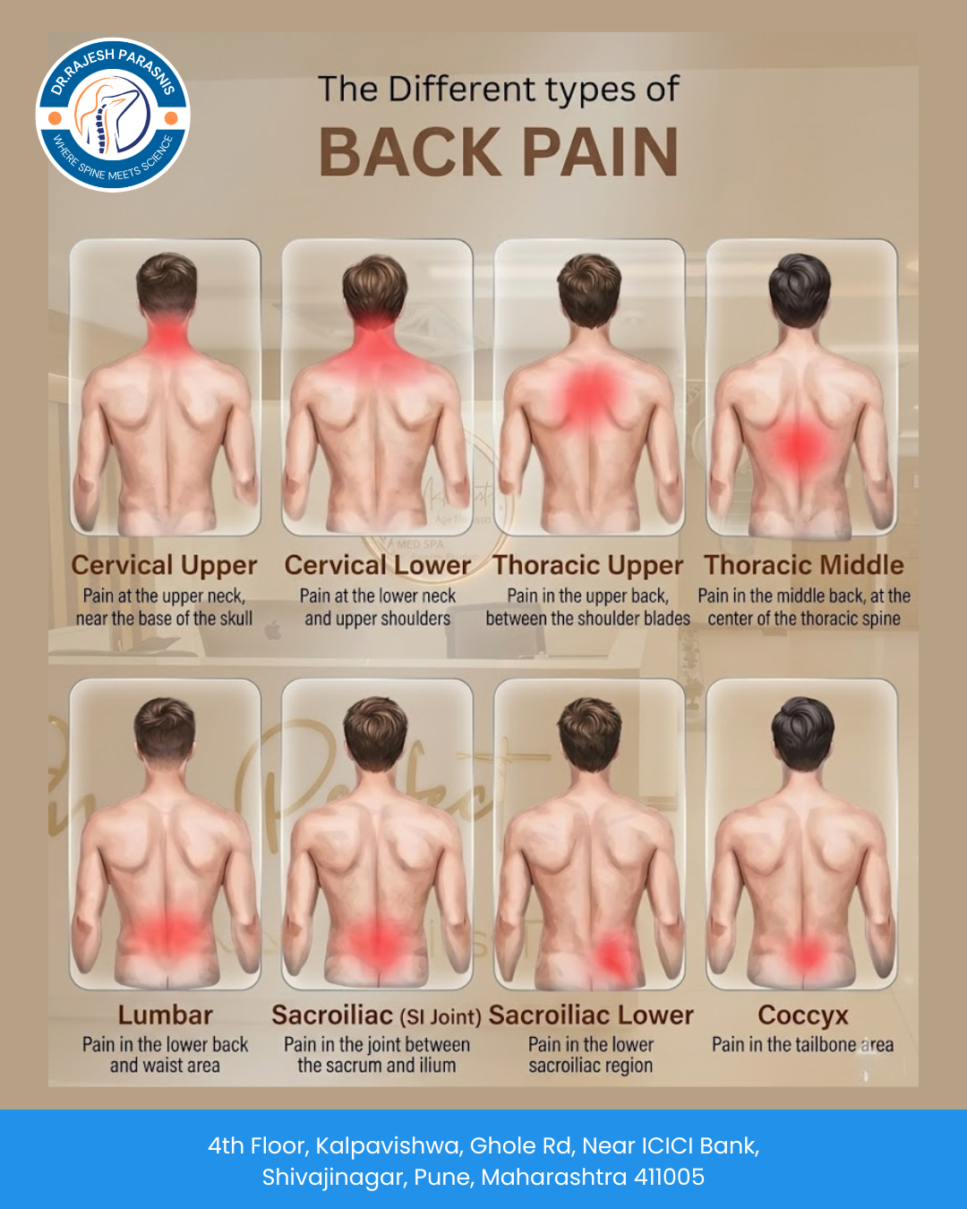 Different Types of Back Pain