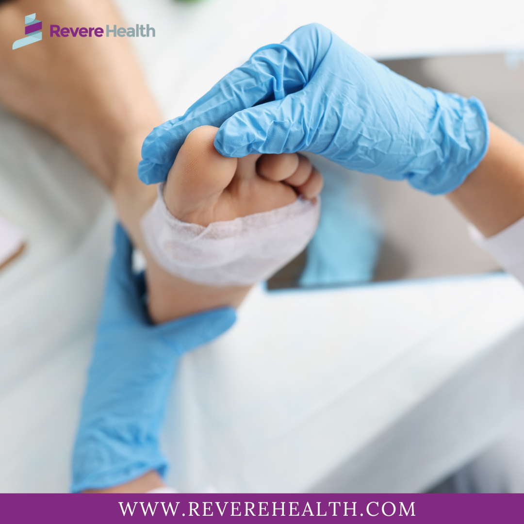 Foot Ankle Doctors Near Me Revere Health Revere Health Medium