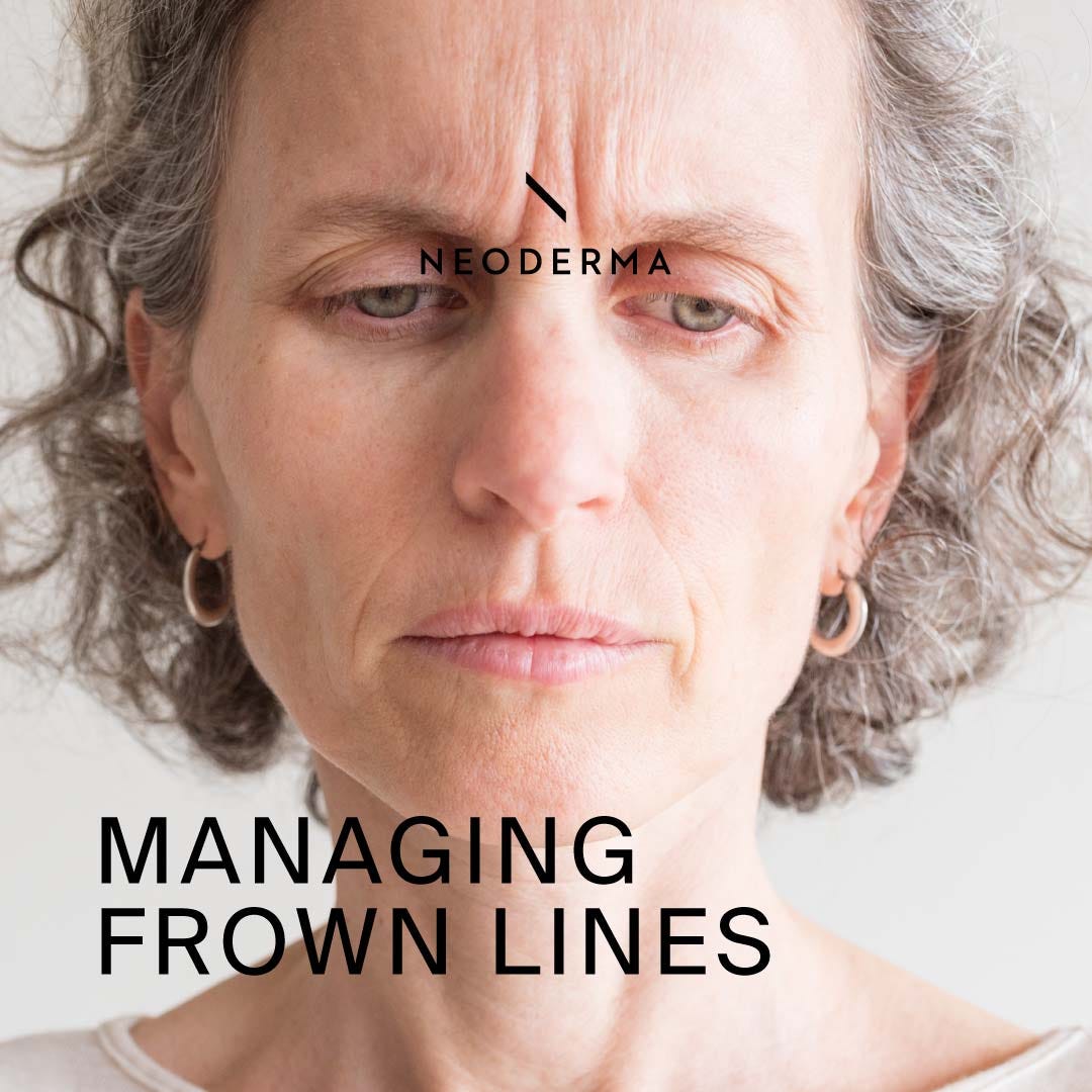 Frown Lines NEODERMA. Do you want to know about frown lines… by