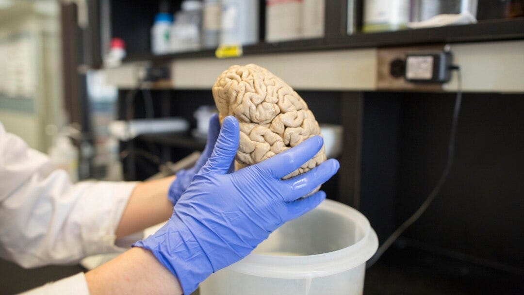 Scientists use brain-like tissue in advance for ‘biocomputing’ research ...