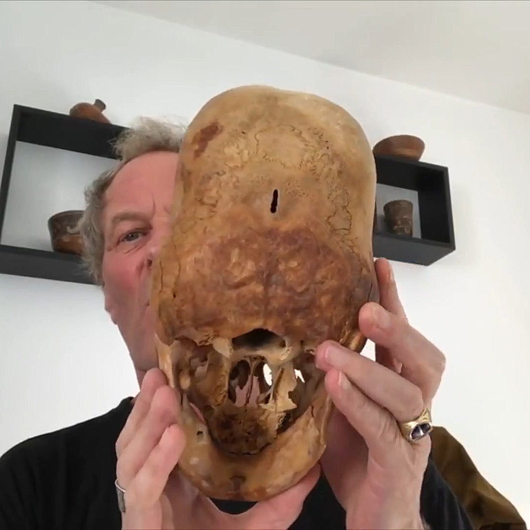 Natural skull from behind