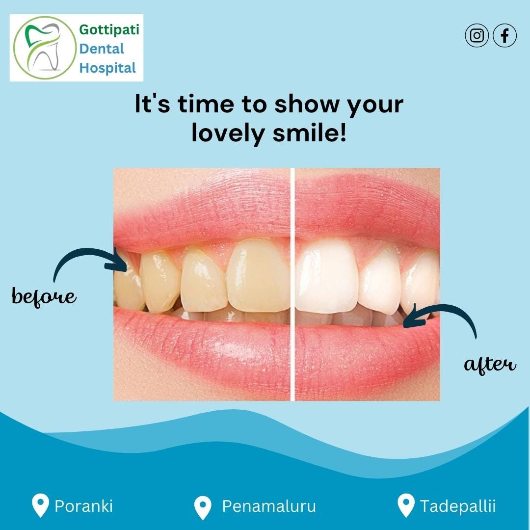 “False Teeth, Are you afraid of losing your tooth? We have a solution for you to be able to keep