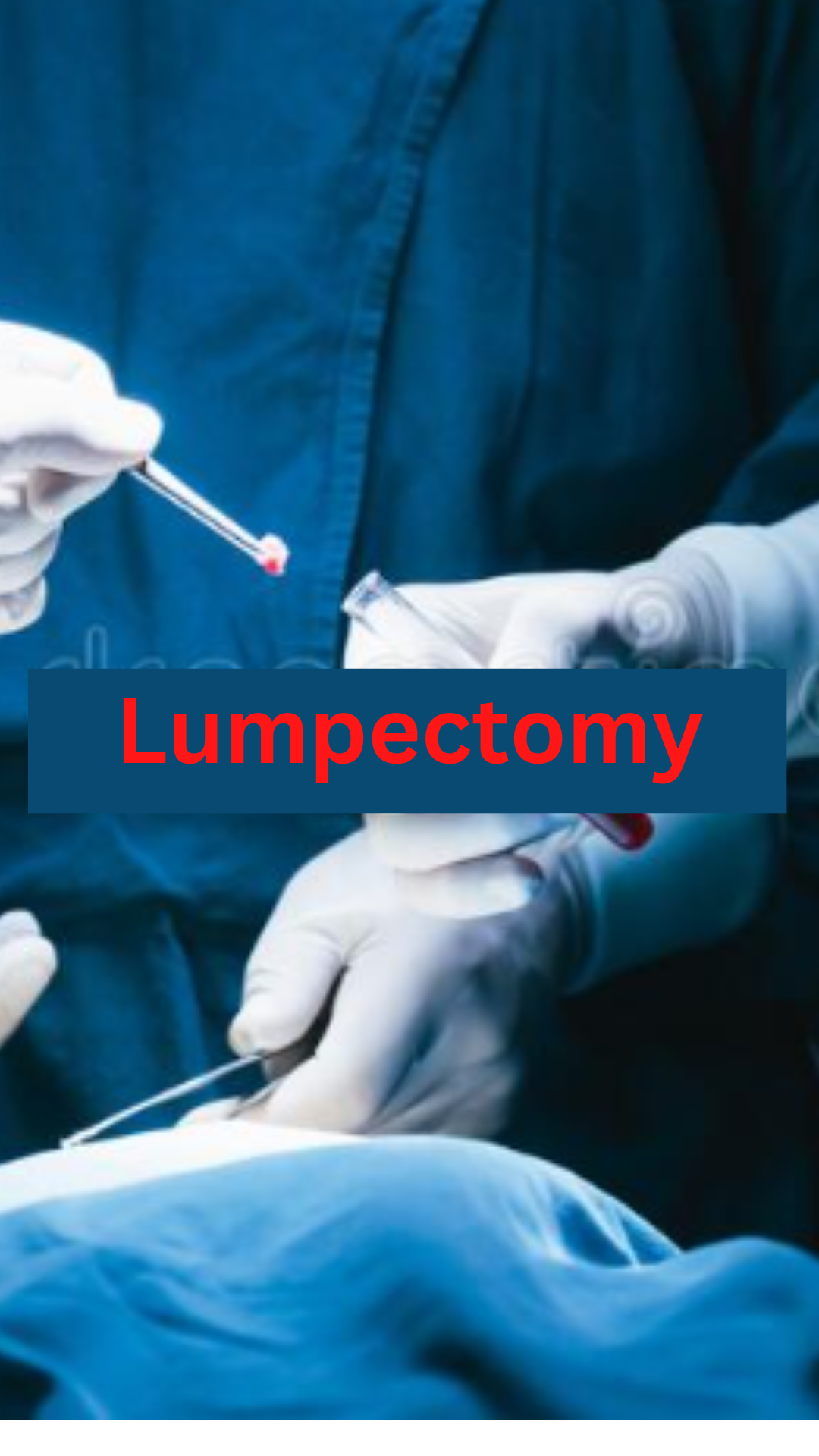 Lumpectomy Procedure Overview, Purpose & Treatment Samirpandey Medium