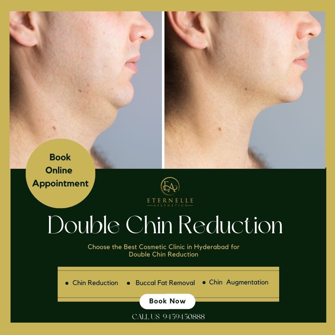 double-chin-reduction-in-hyderabad-chin-reduction-surgery-the-cost