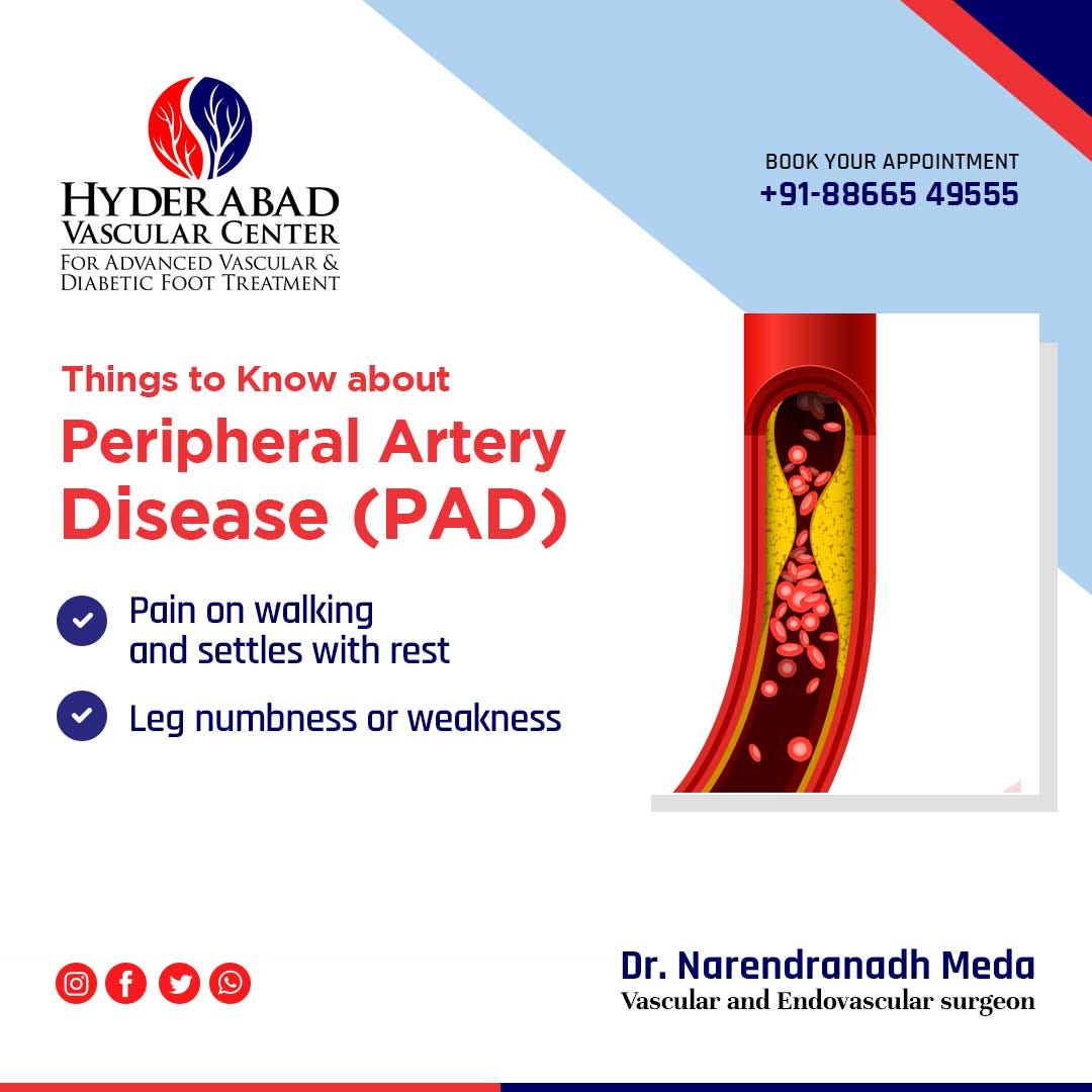 Peripheral Arterial Disease And Its Prevention By Hyderabad Vascular peripheral-arterial-disease-and-its-prevention-by-hyderabad-vascular