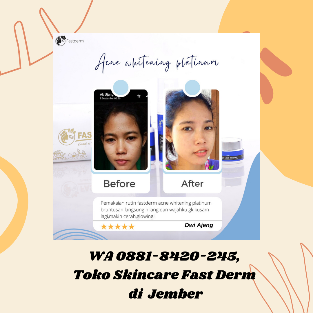 WA 08818420245, Toko Skincare Fast Derm di Jember by Agen Skincare