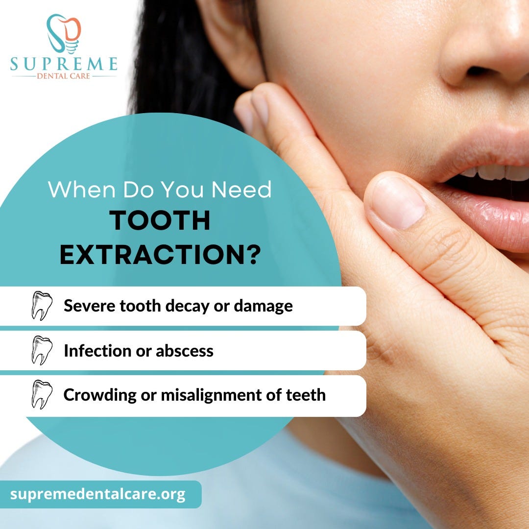 When Goodbye is Necessary Reasons for Tooth Extraction by Supreme