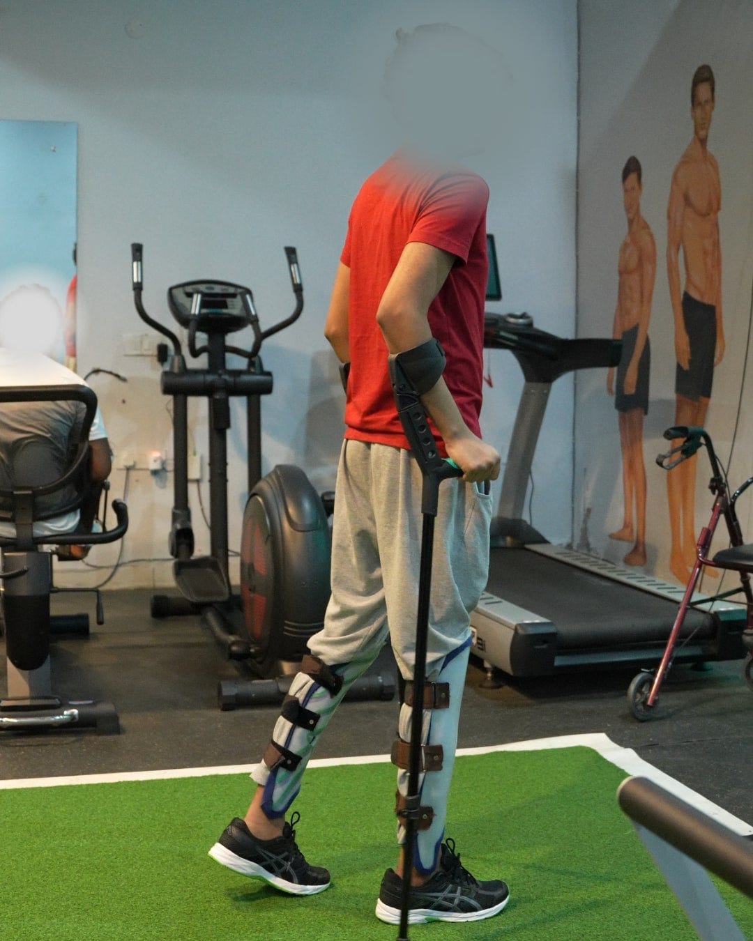 Limb Lengthening in India: Complete Guide for Patients (2026)
