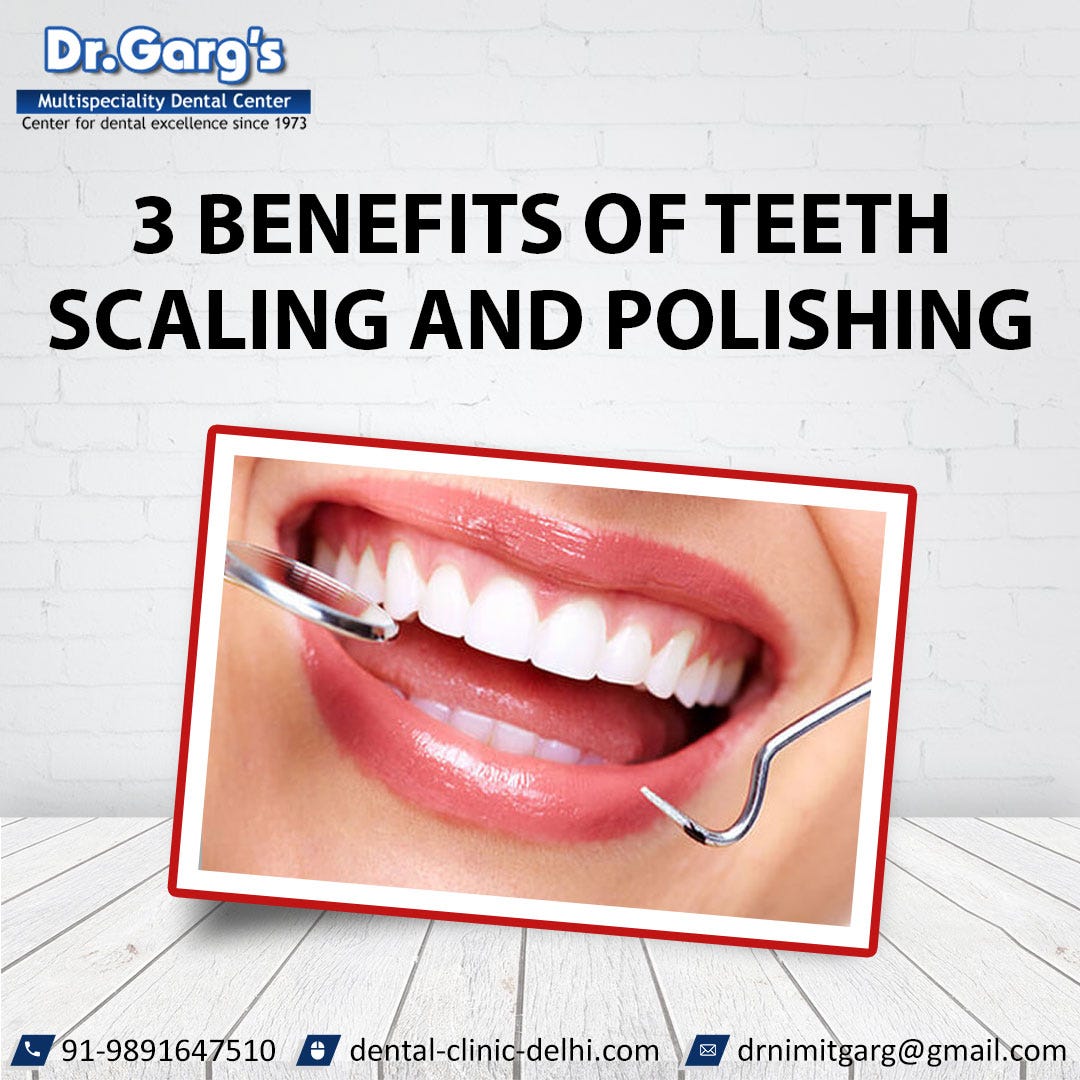 3 Benefits of Teeth Scaling and Polishing by Nimit Garg Medium