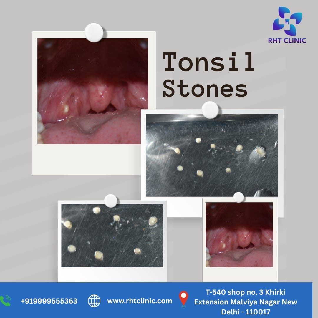 Persistent bad breath, throat irritation, or a feeling that something is stuck in your throat?