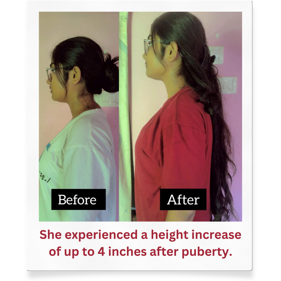 Can Posture Correction Help You Gain Height After Puberty? by