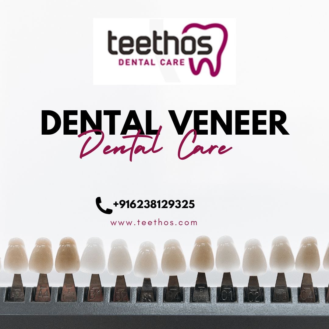 The Truth About Dental Veneer Costs in Kerala, Everybody Should Know