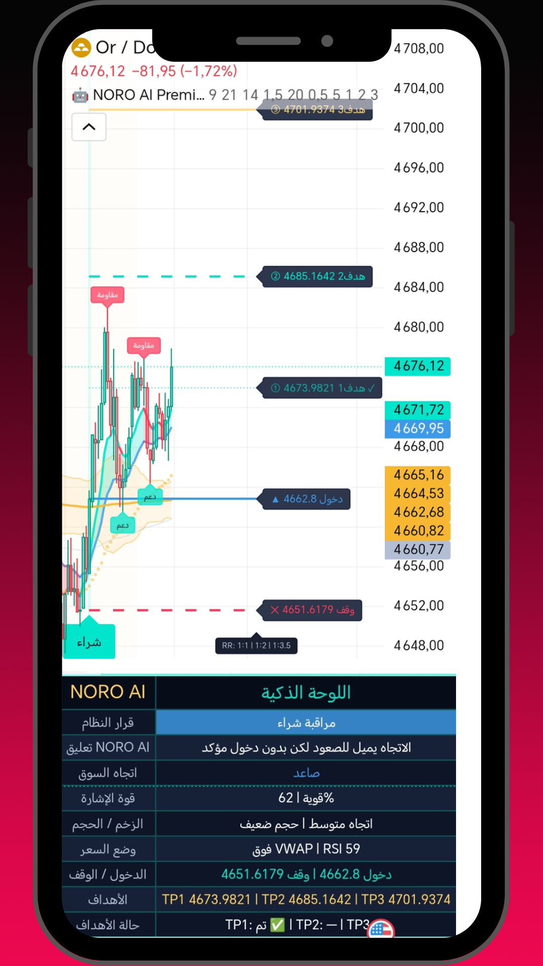 مؤشر NORO AI Premium مقابل RSI: أيهما الأفضل لتداول الخيارات الثنائية؟