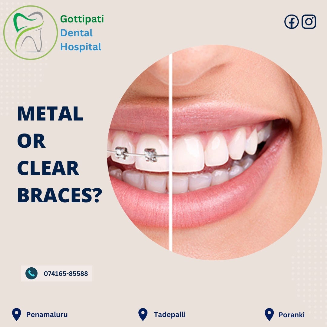 Best braces dental hospital in vijayawada Gottipati Dental Hospital