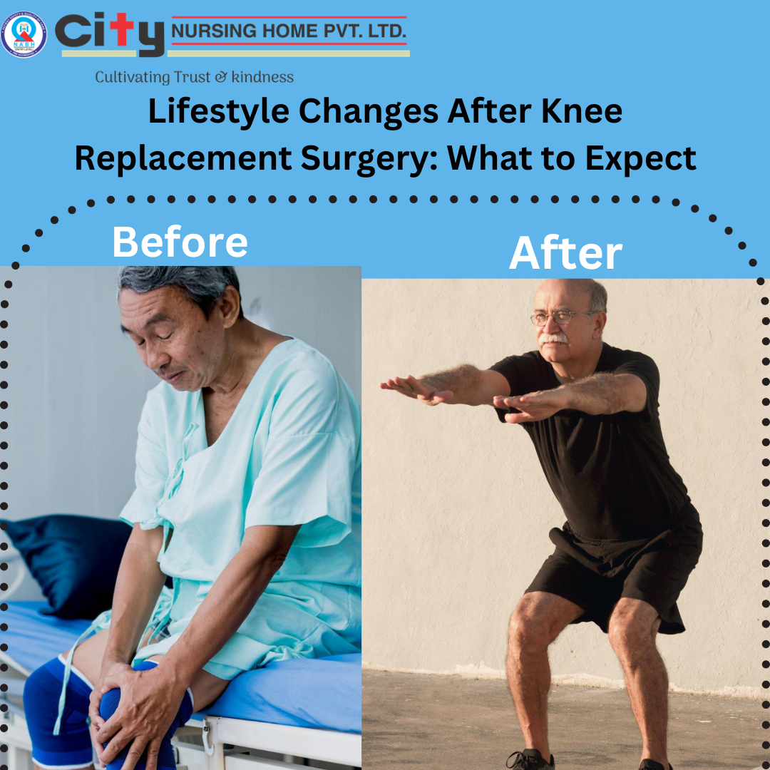 Lifestyle Changes After Knee Replacement Surgery What to Expect by