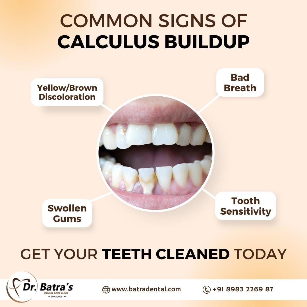 Common Signs of Calculus Buildup — Keeping Your Smile Healthy at Batra