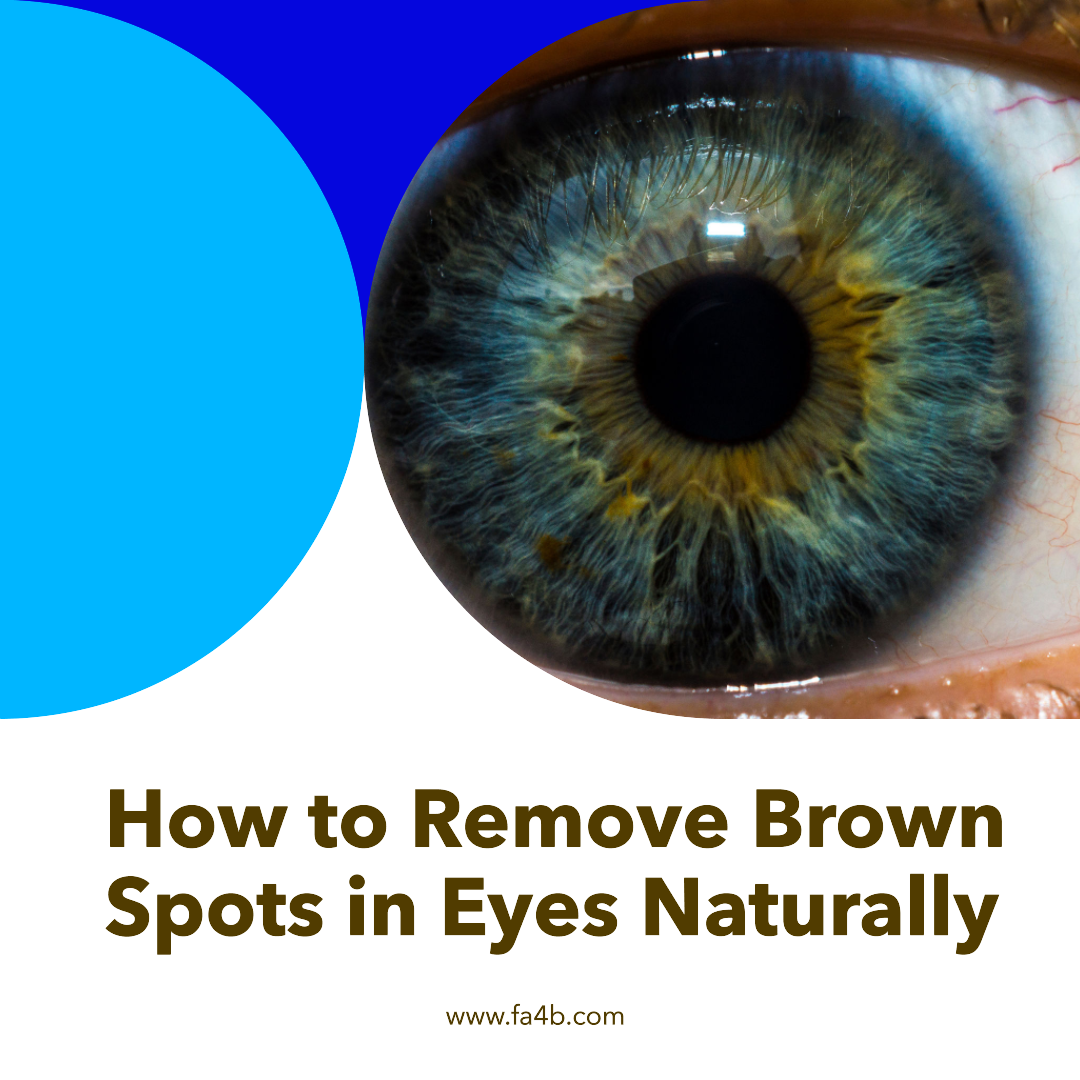 how-to-remove-brown-spots-in-eyes-naturally-by-fashion-beauty-medium