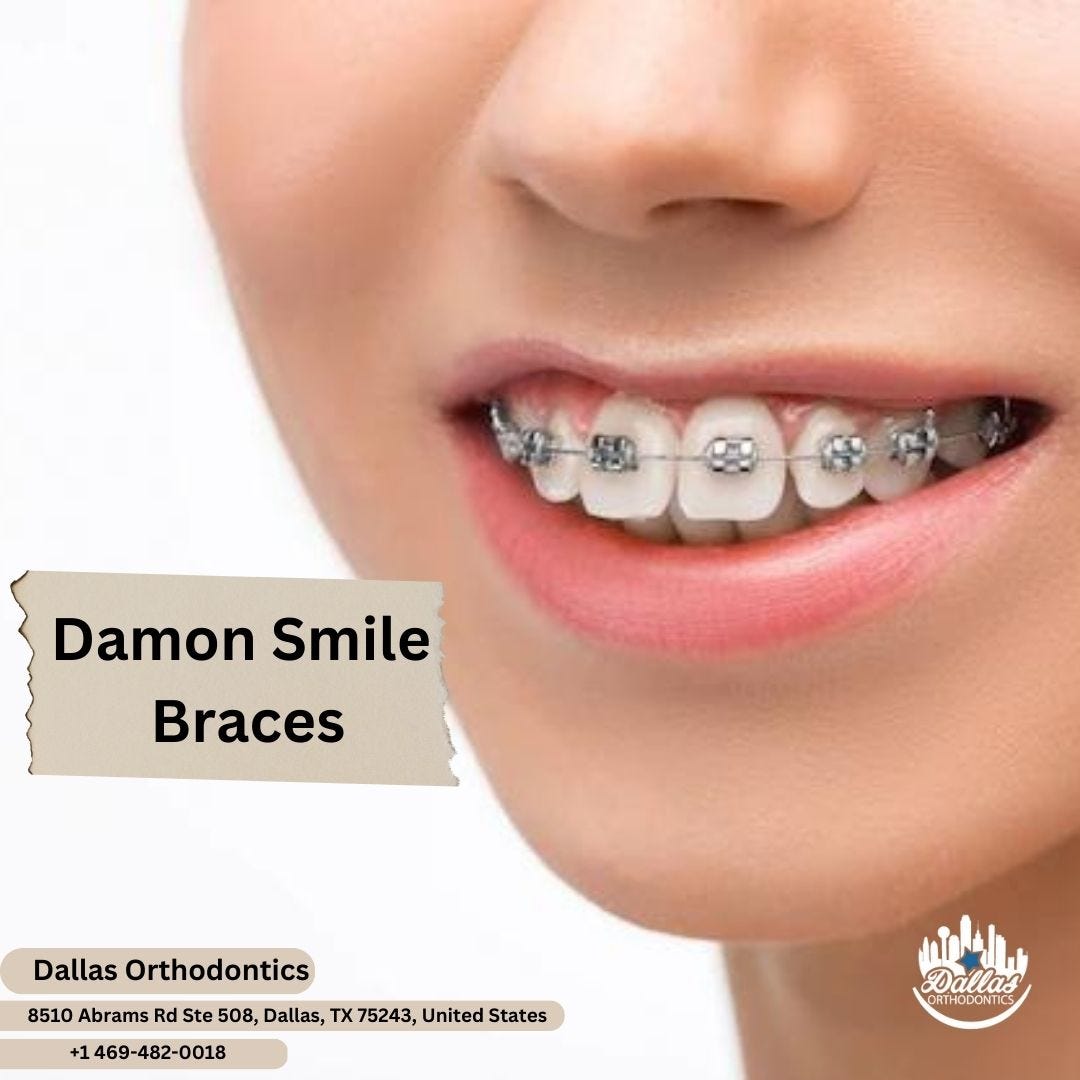 How Damon Smile Braces Work? Benefits of Damon Smile Braces Dallas