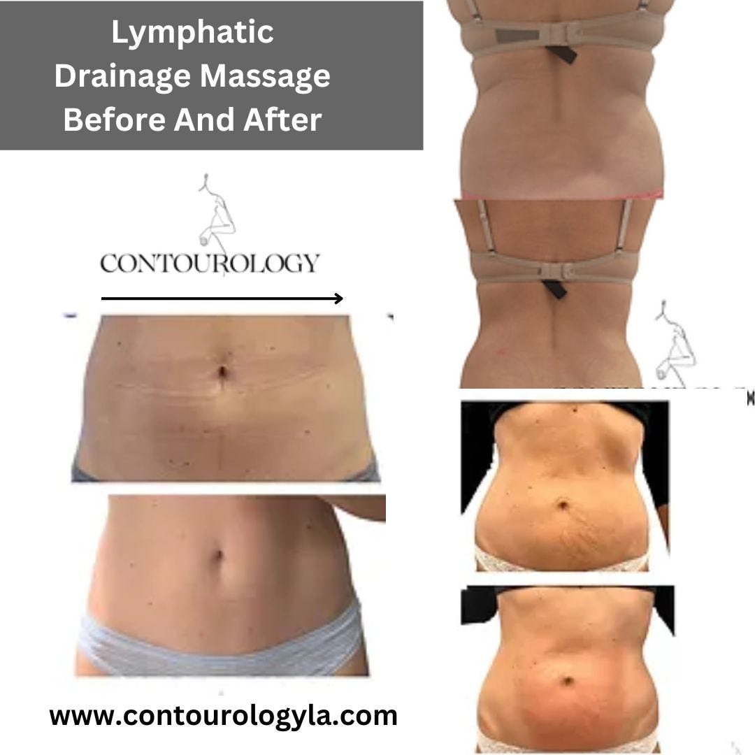 Lymphatic Drainage Massage Before And After Contourology Body and