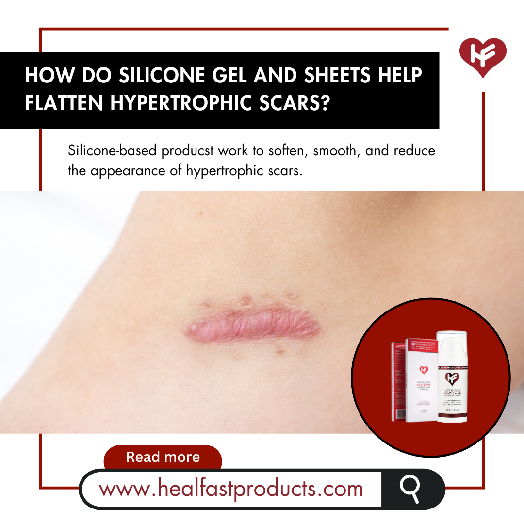 How do Silicone Gel and Sheets help Flatten Hypertrophic Scars?
