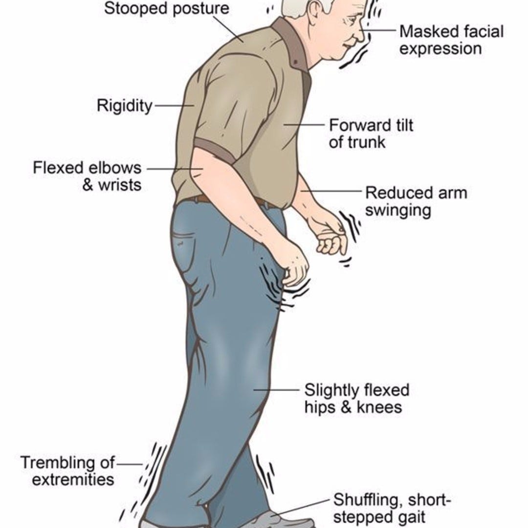 Parkinson’s Disease: A Challenge For The Brain And Body 