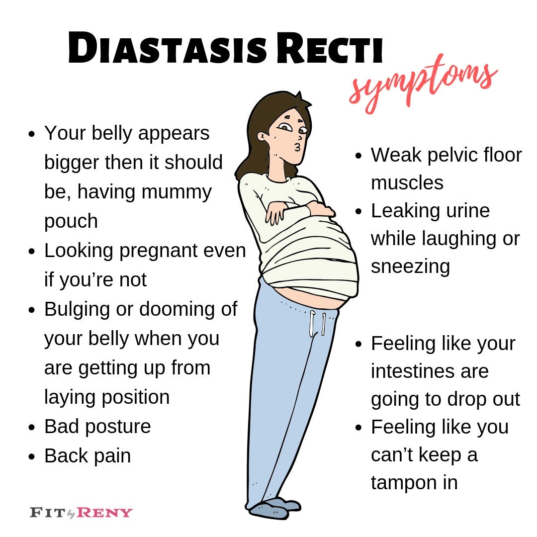 What are the symptoms of Diastasis Recti? by Renata Sanko Medium