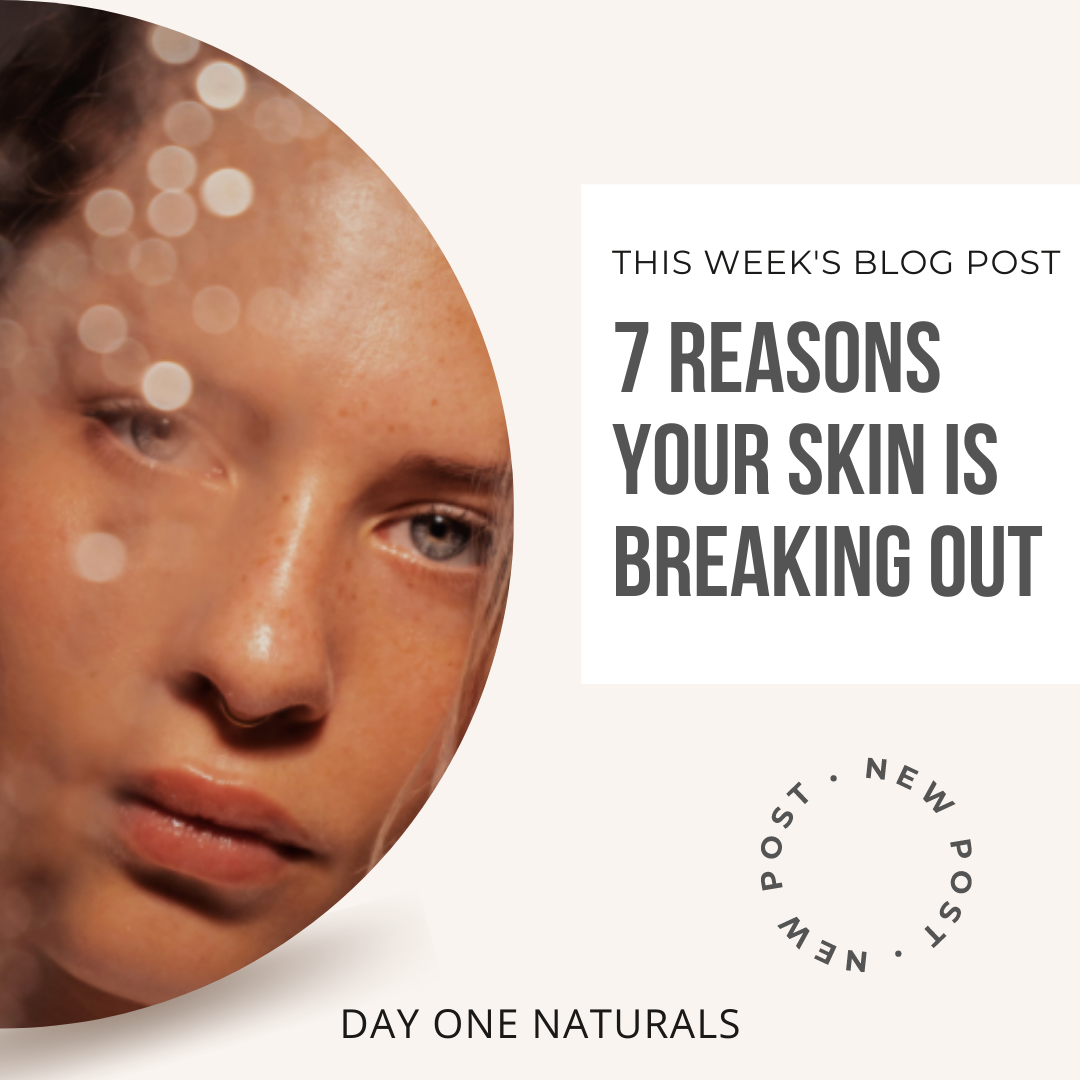 seven-reasons-your-skin-is-breaking-out-by-day-one-naturals-medium