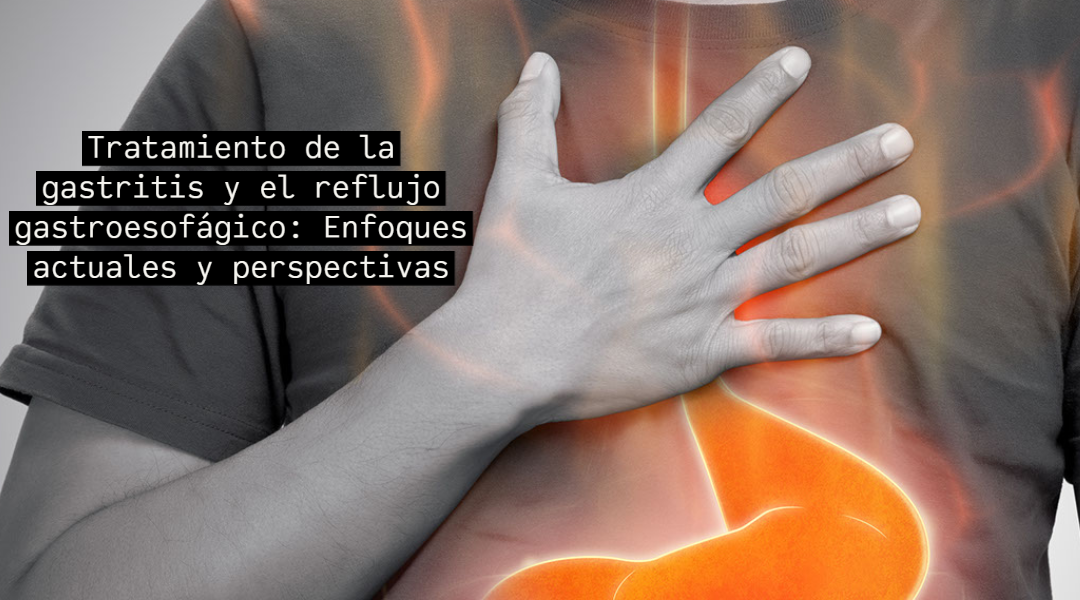 Tratamiento de la gastritis y el reflujo gastroesofágico Enfoques
