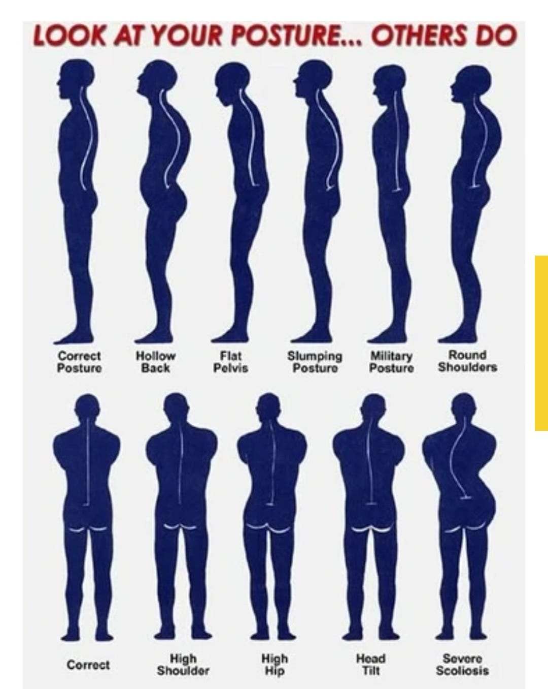 Fun With Posture. A great number of people suffer from…, by Ramla Younas