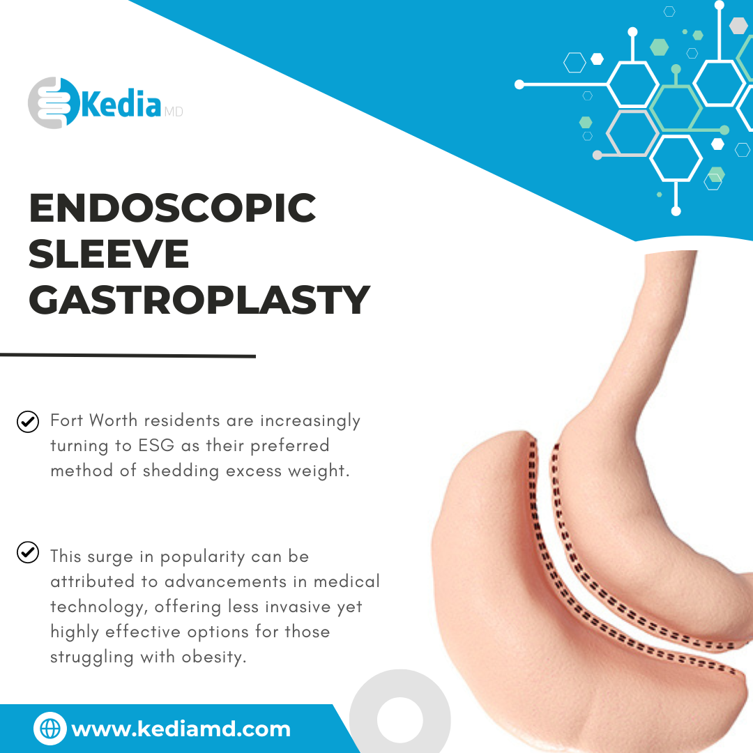 Unveiling the Benefits Endoscopic Sleeve Gastroplasty in Dallas, Texas