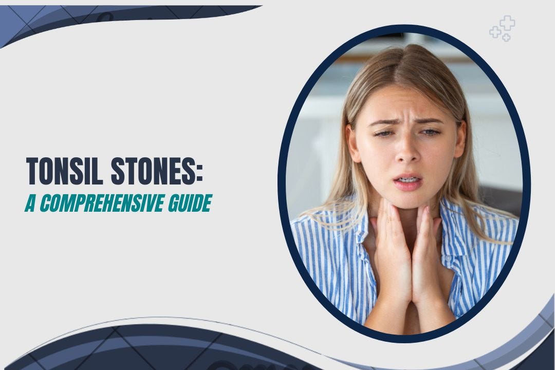 Tonsil Stones Causes, Symptoms, and Treatment — A Comprehensive Guide