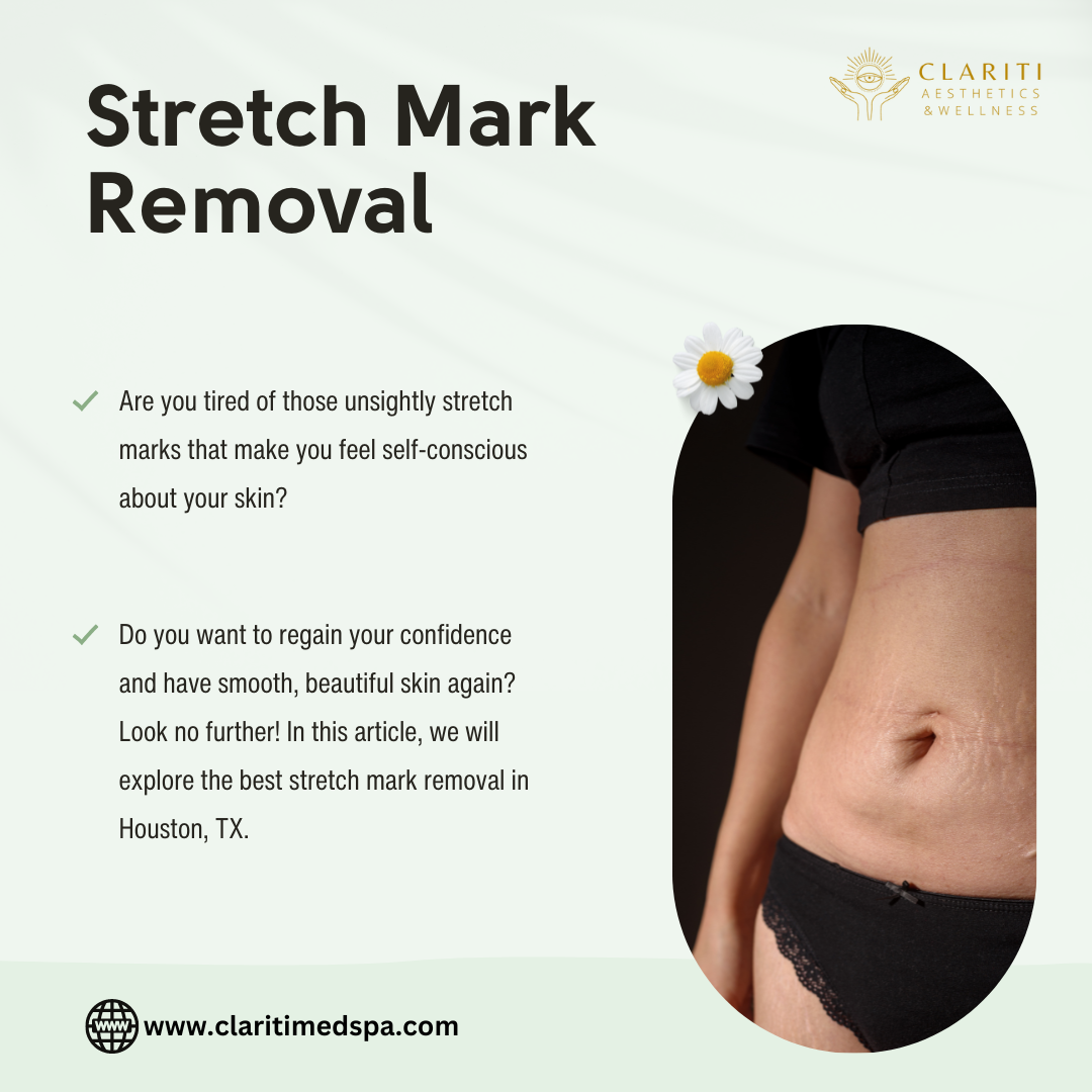 Smooth and Beautiful Discover the Best Stretch Mark Removal in Houston
