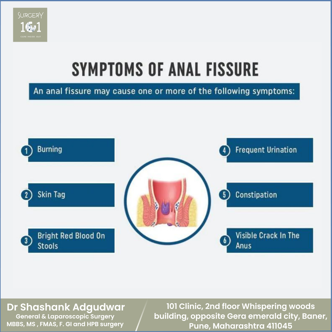 Symptoms of Anal Fissure