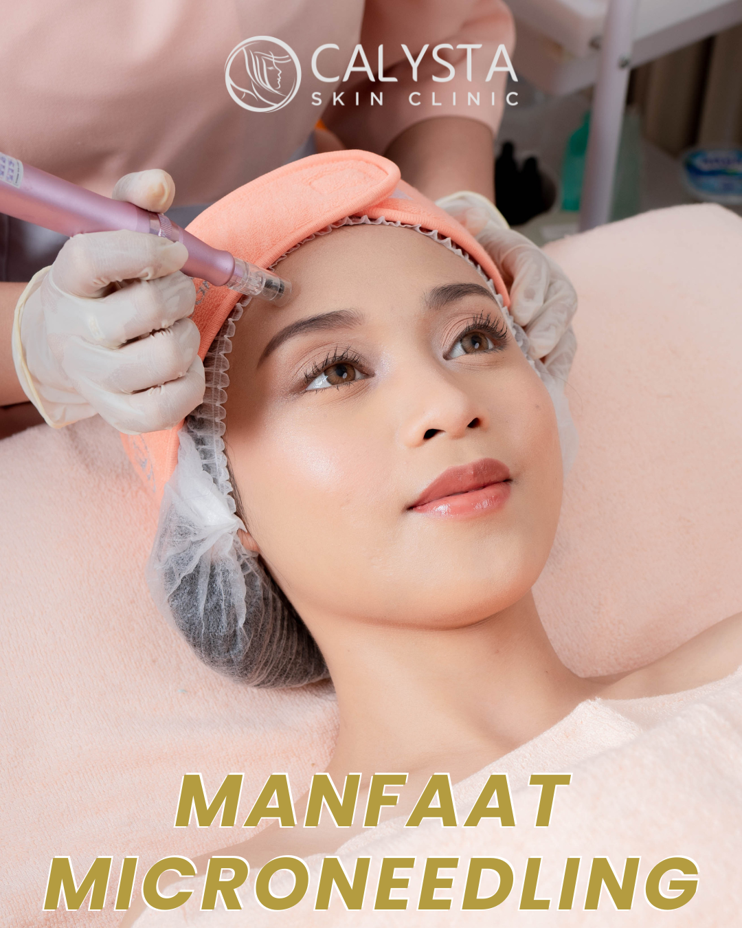 Apa itu Microneedling/Dermapen