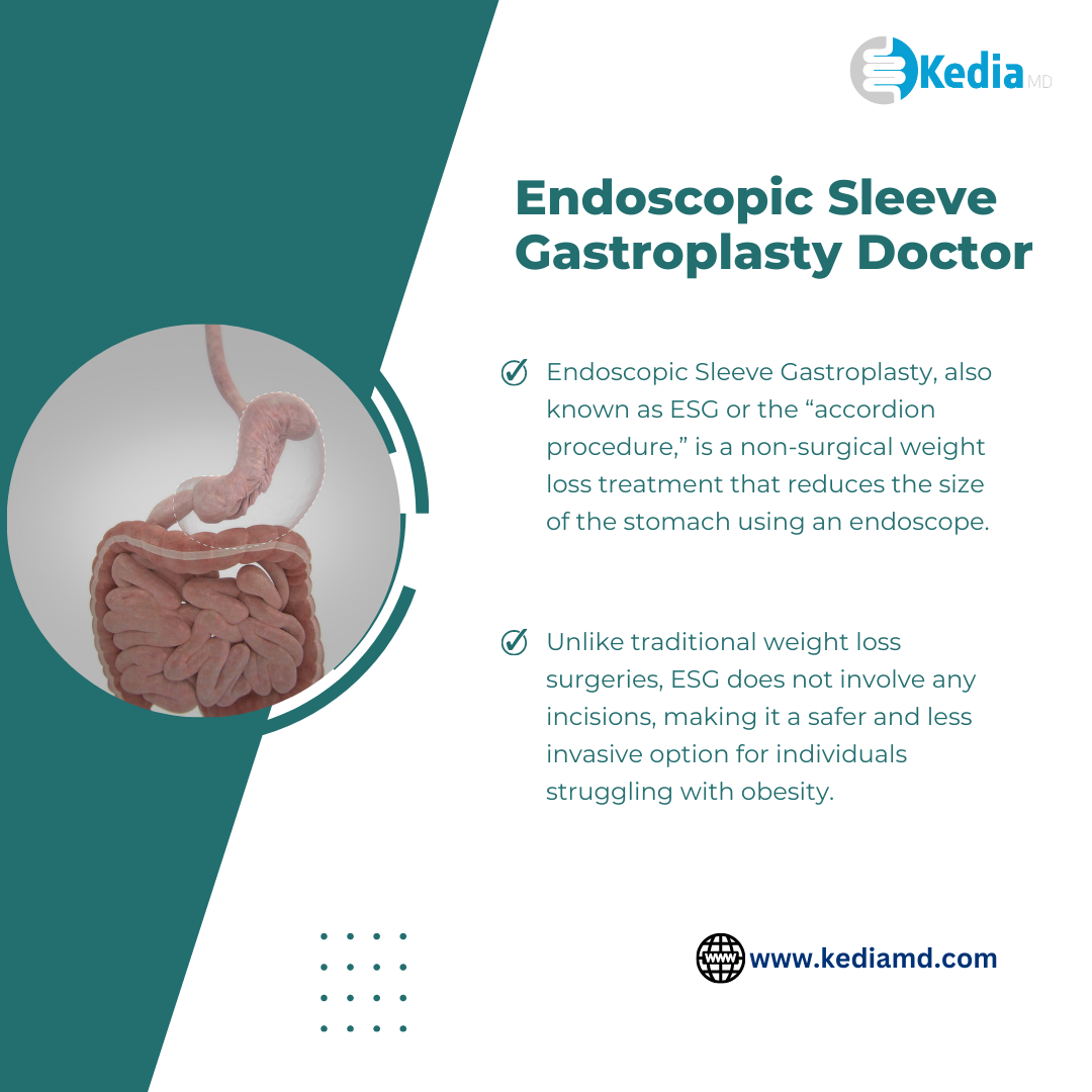 The Best Endoscopic Sleeve Gastroplasty Doctors in Dallas, TX Your