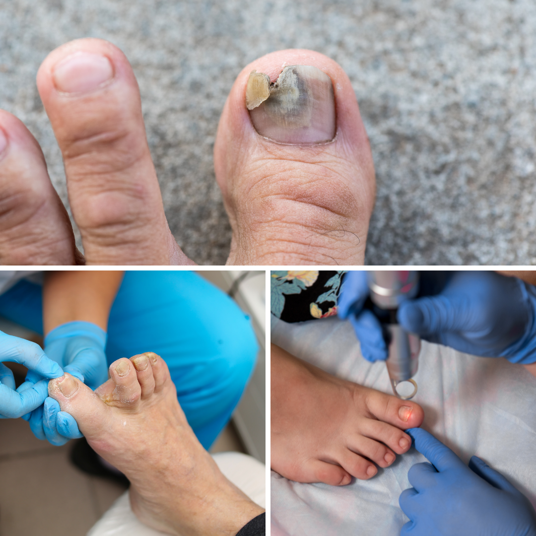 Thick Toenails: Diagnosis, Pictures, Causes, and Treatments