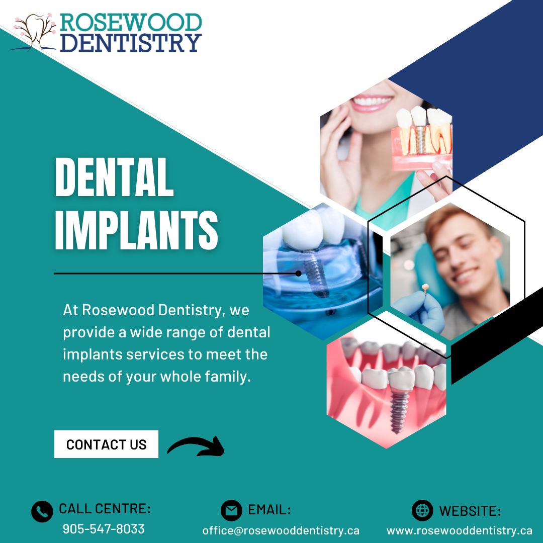 Choosing the Right Dental Implant Size Tips for Optimal Fit and