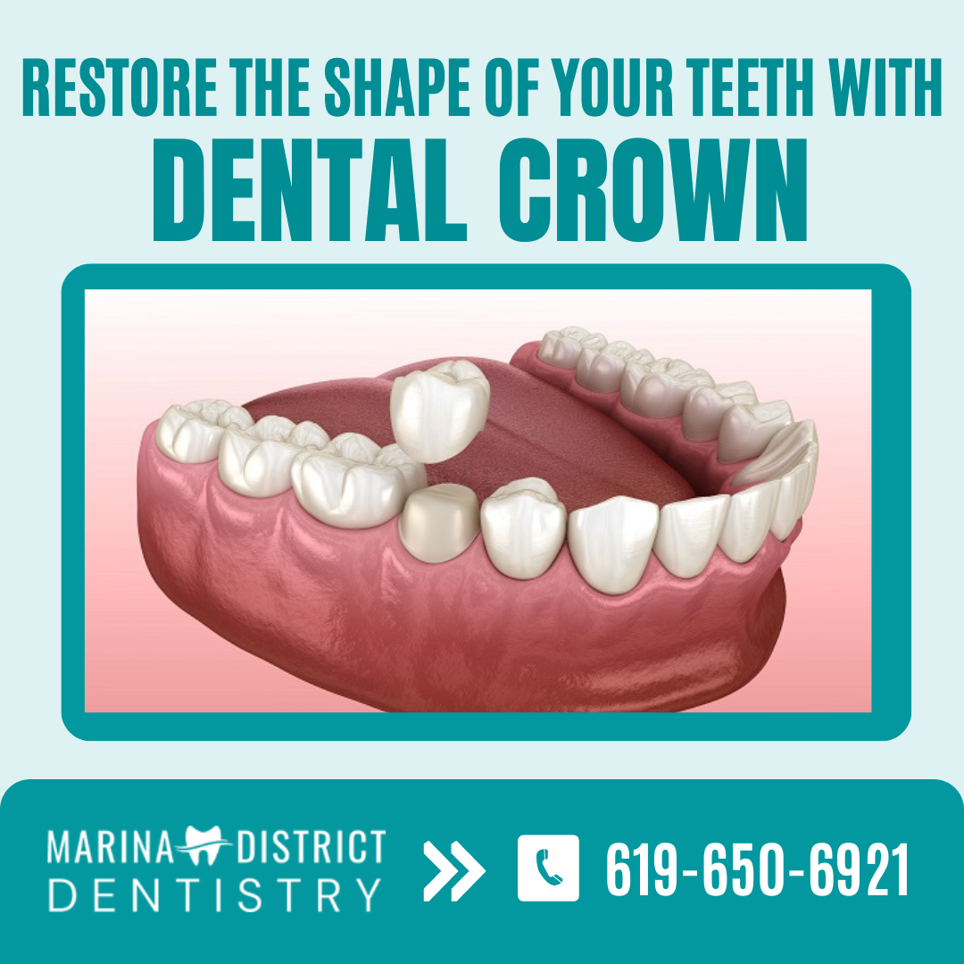 Protect Your Weak Tooth with Dental Crown! Marina District Dentistry