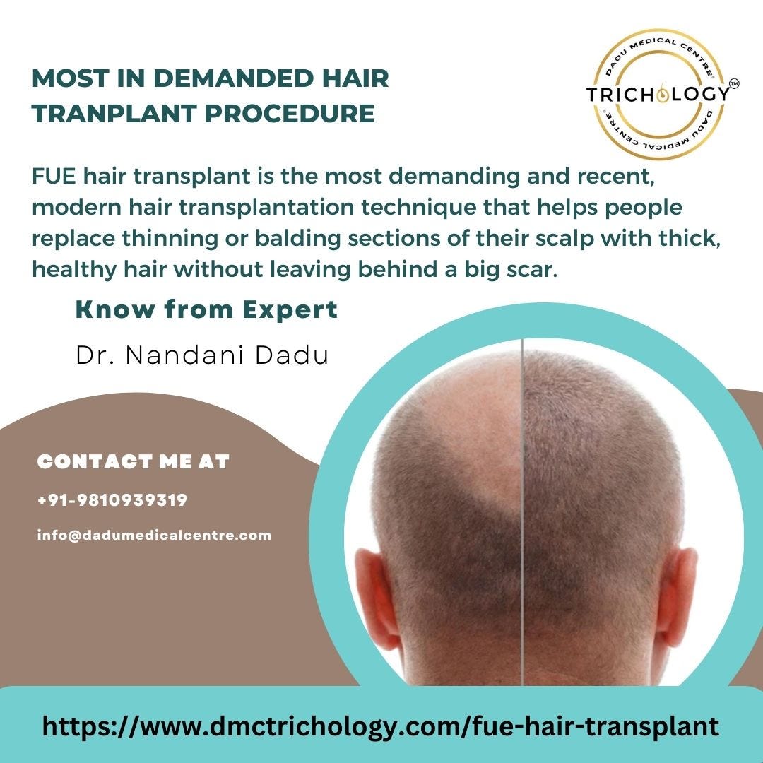 FUE Hair Transplant In Delhi — Most In Demanded Hair Tranplant ...