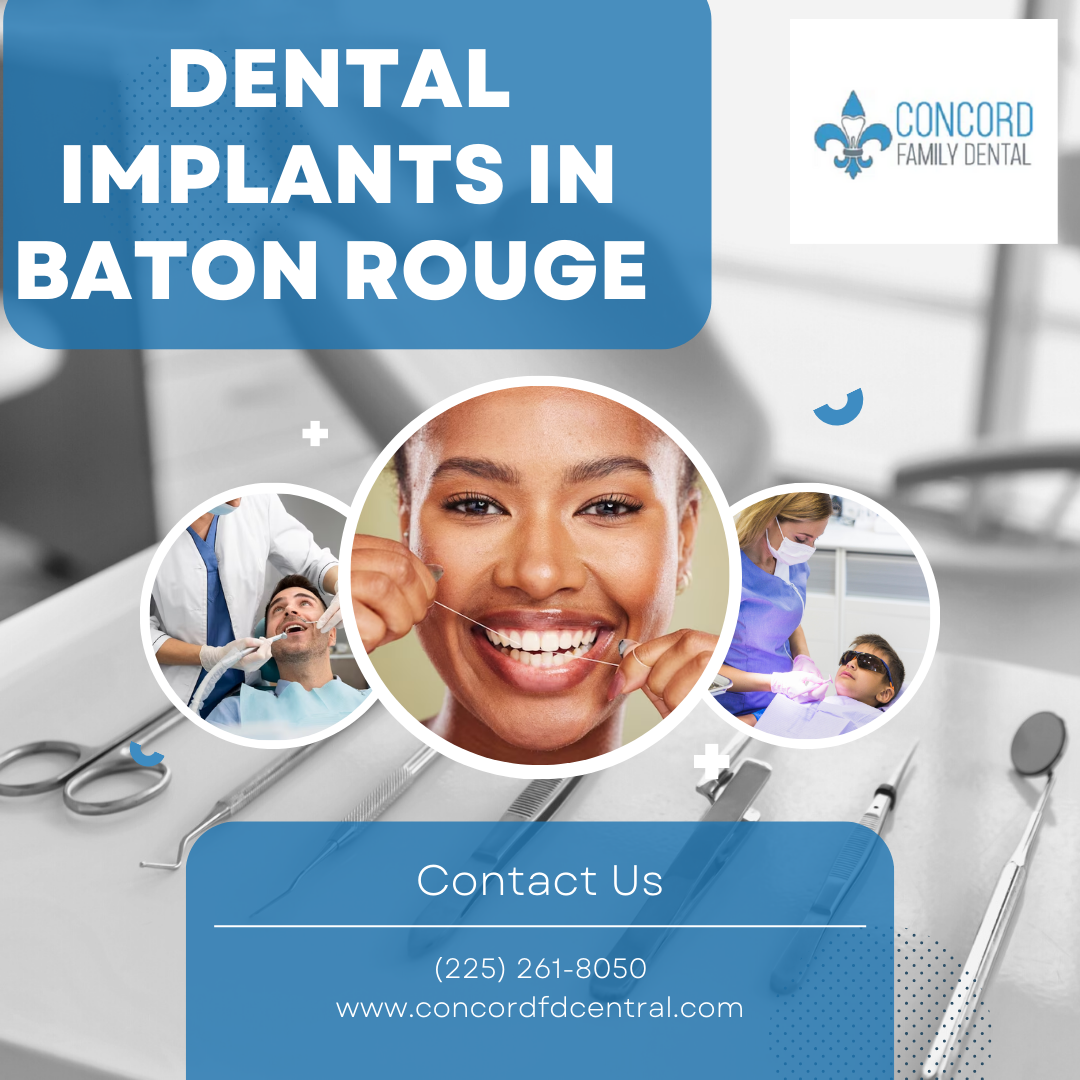 Dental implants in Baton Rouge Concordfdcentral Medium