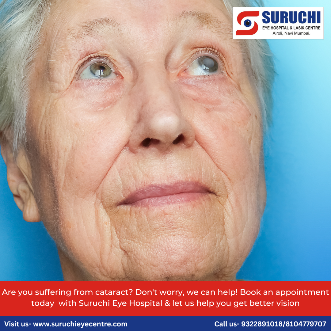 Essential Precautions After Cataract Surgery A Guide for Patients by