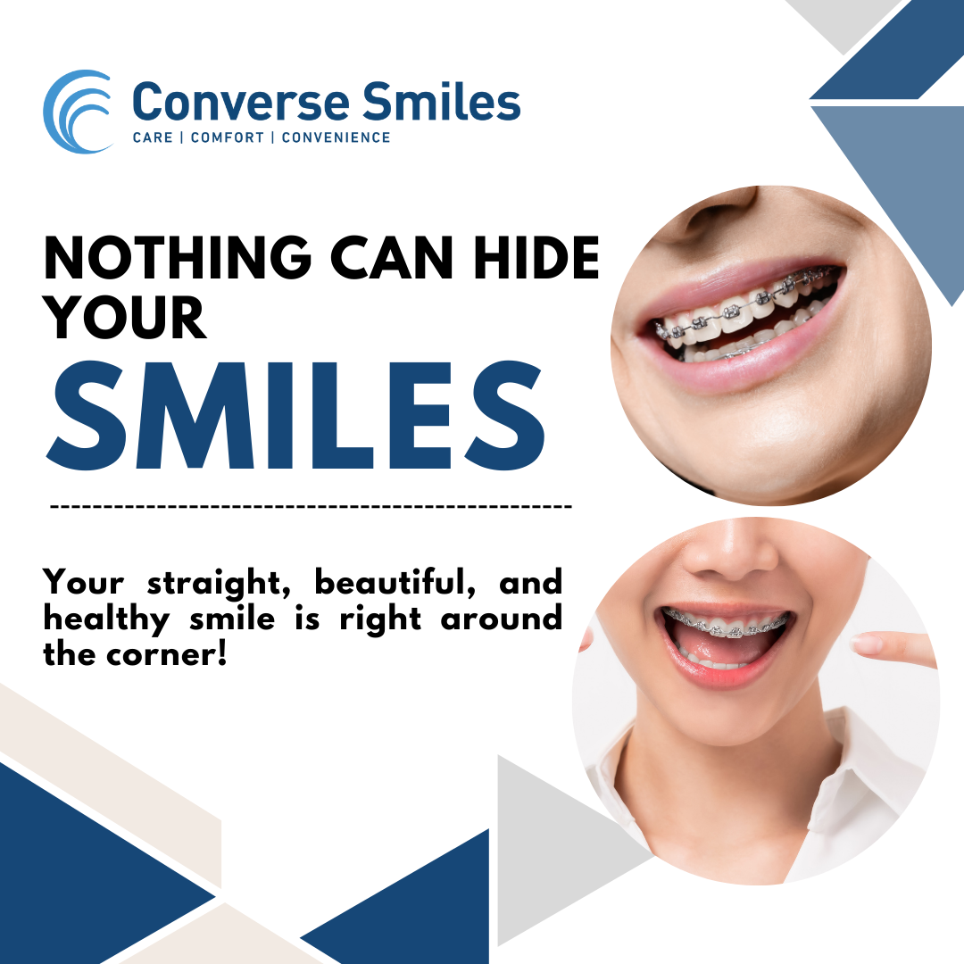 Smile With Best Dental Sealants Services In Converse TX - Converse Smiles -  Medium