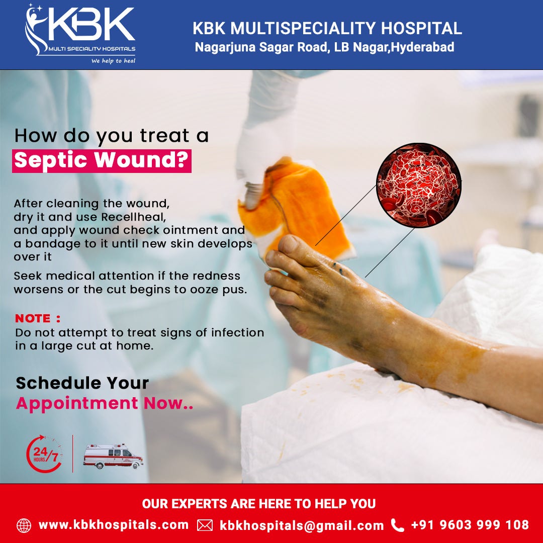 𝑯𝒐𝒘 𝒅𝒐 𝒚𝒐𝒖 𝒕𝒓𝒆𝒂𝒕 𝒂 𝒔𝒆𝒑𝒕𝒊𝒄 𝒘𝒐𝒖𝒏𝒅? KBK Hospitals Medium