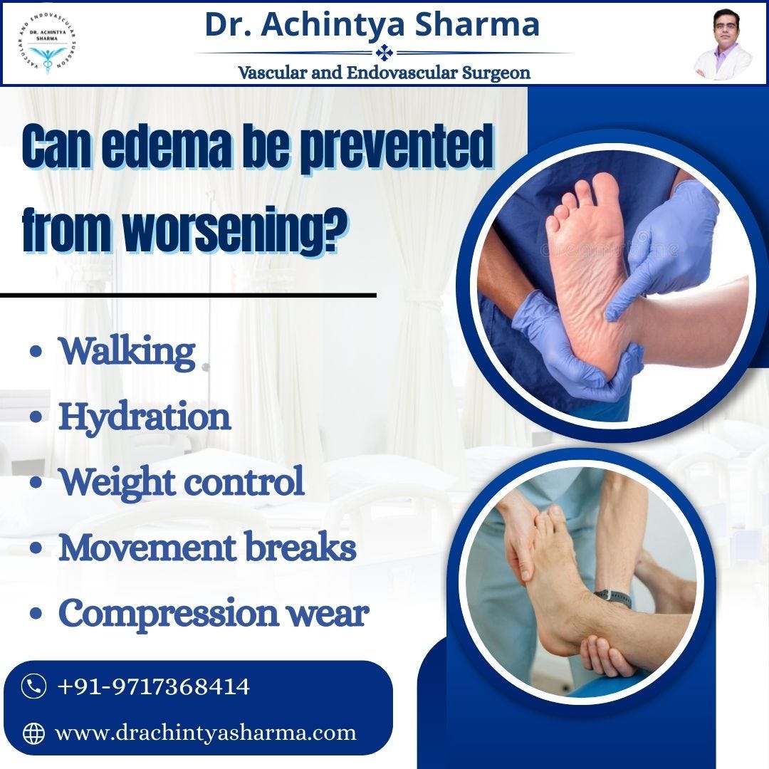 Edema vs Normal Leg Swelling: When Is It a Medical Concern?