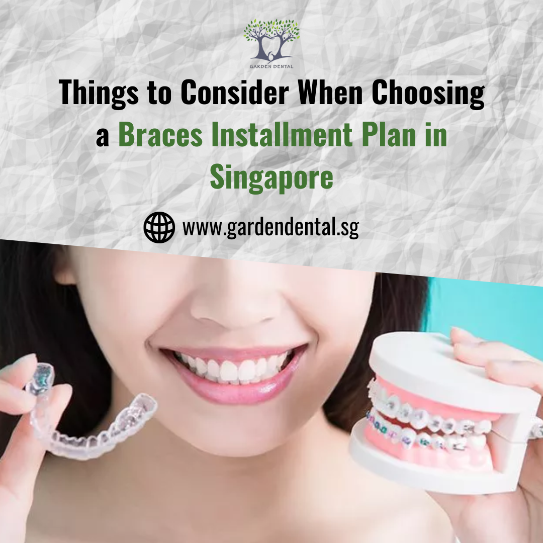 Things to Consider When Choosing a Braces Installment Plan in Singapore