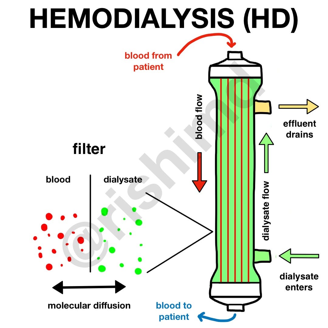 Is there a distinction between dialysis and hemodialysis? by Poonam